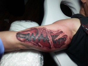 Shock on Arm